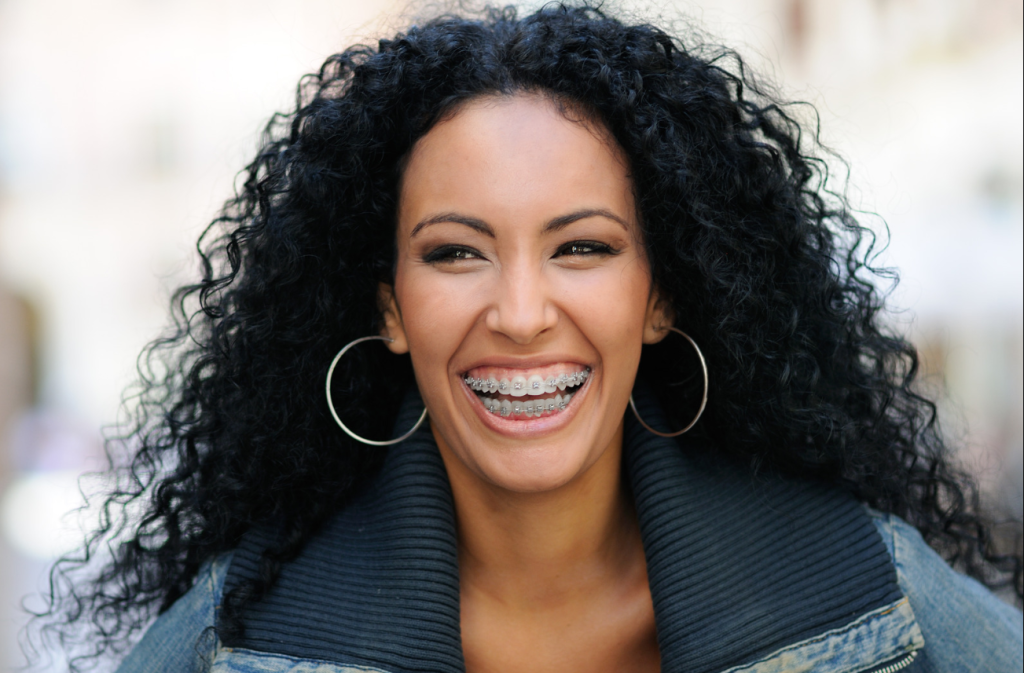 Clear Ceramic Braces