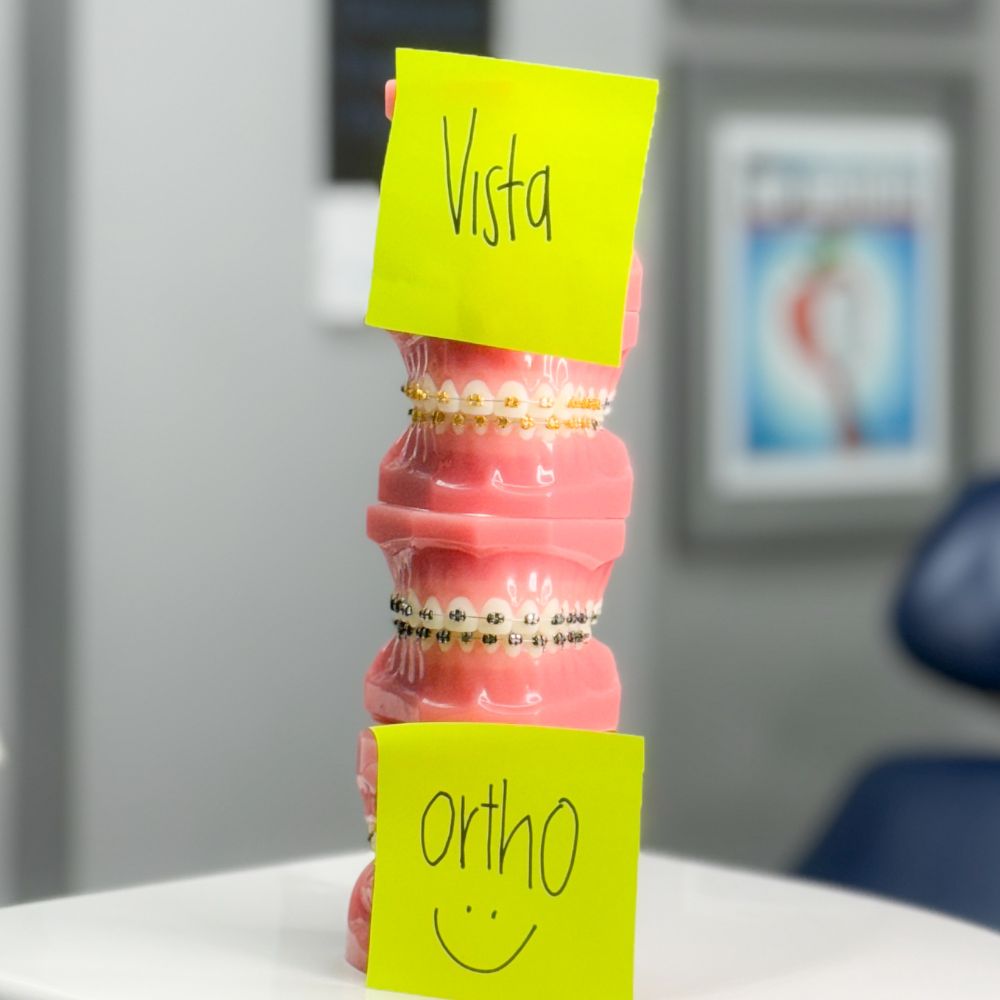 a close up of a model of teeth