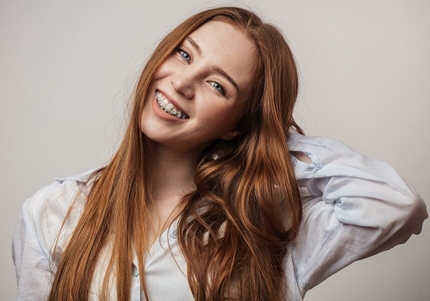 clear-ceramic-braces clear-ceramic-braces