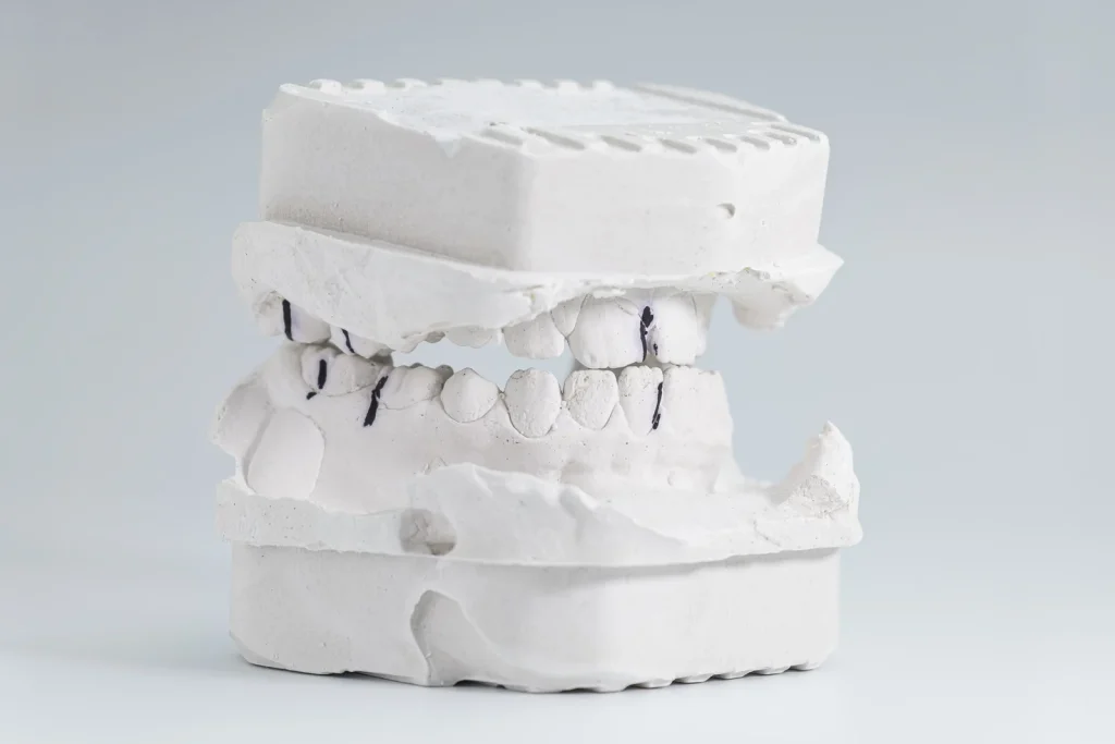 Why Choose Professional Orthodontics for a Healthier Smile?